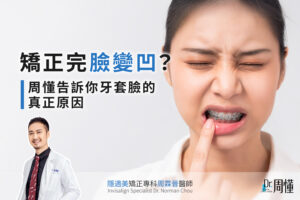 矯正完臉變凹?周懂告訴你牙套臉的真正原因