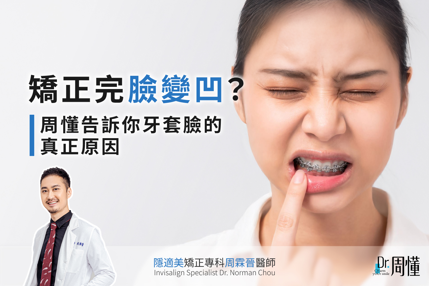 矯正完臉變凹？周懂告訴你牙套臉的真正原因