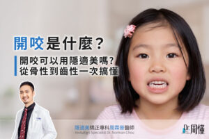 開咬是什麼?開咬可以用隱適美矯正嗎?從骨性到齒性一次搞懂