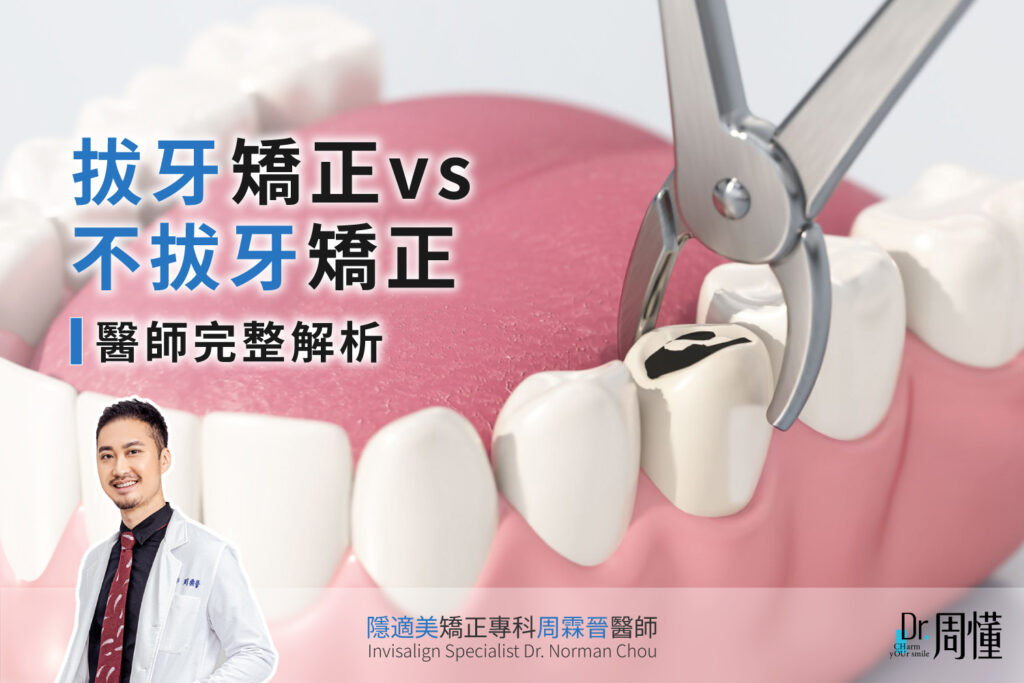拔牙矯正vs不拔牙矯正，哪個適合你？醫師完整解析｜三峽隱形矯正周霖晉醫師