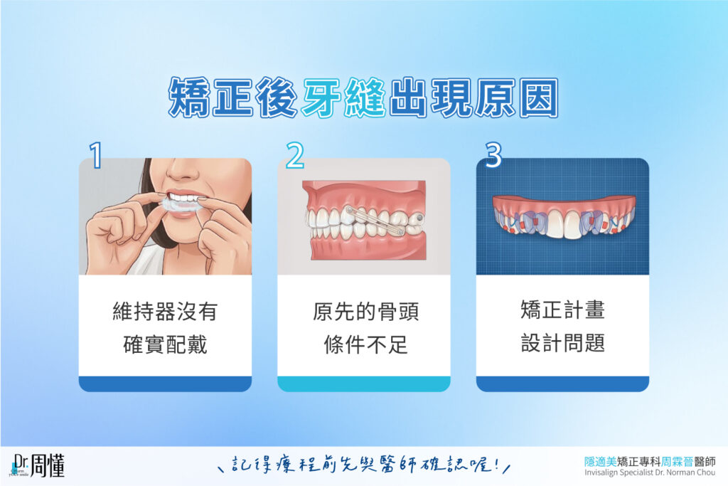 矯正後牙縫出現原因