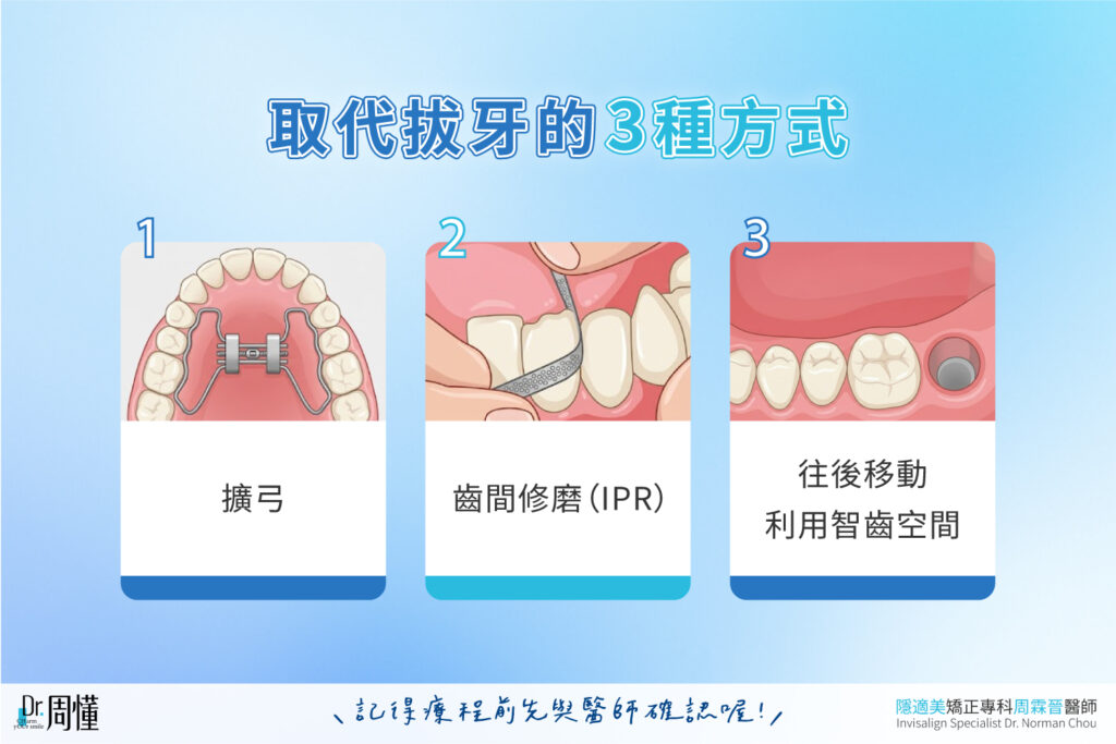 取代矯正拔牙的三種方式